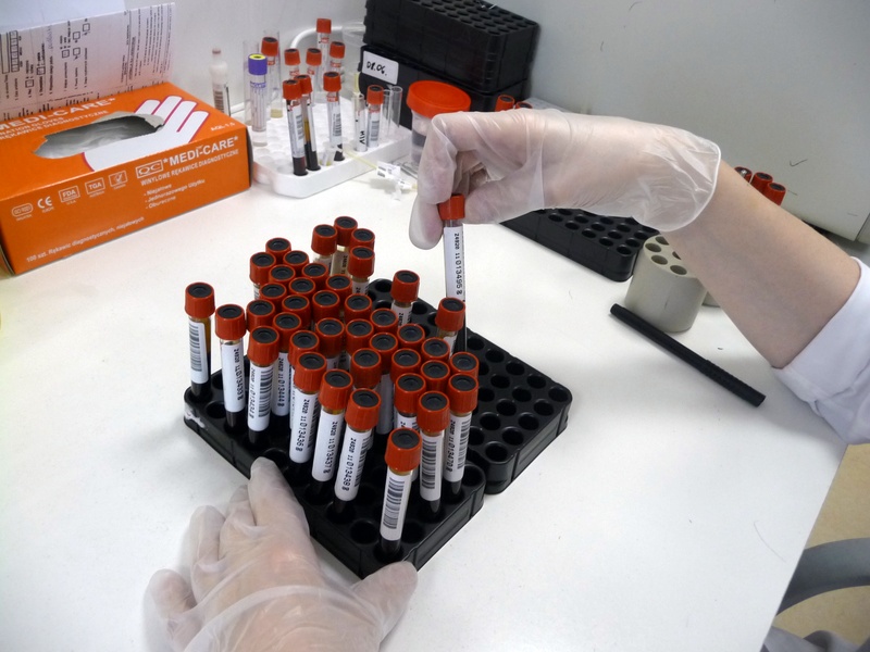 Hajnówka:  Nowoczesne laboratorium do diagnostyki chorób odkleszczowych