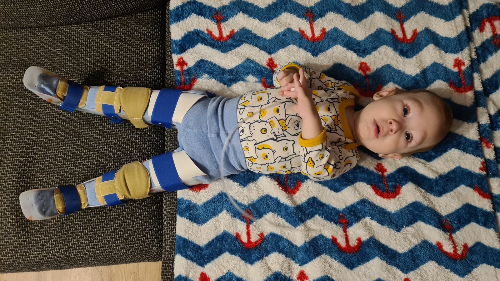 Mały Nikoś choruje na SMA - trwa zbiórka pieniędzy na lek