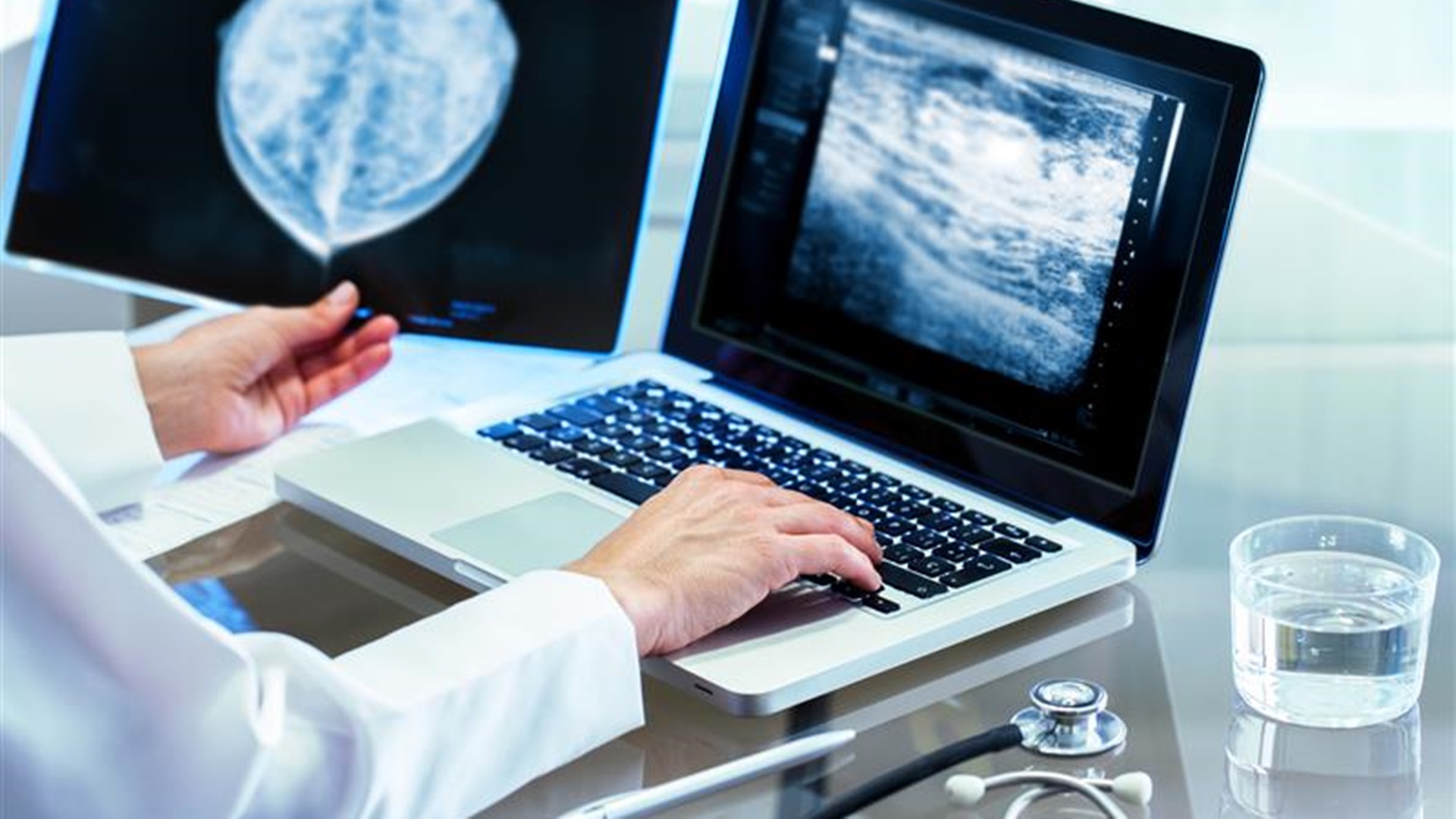 W Białymstoku i Choroszczy odbędą się bezpłatne badania mammograficzne dla kobiet między 50. a 69. rokiem życia