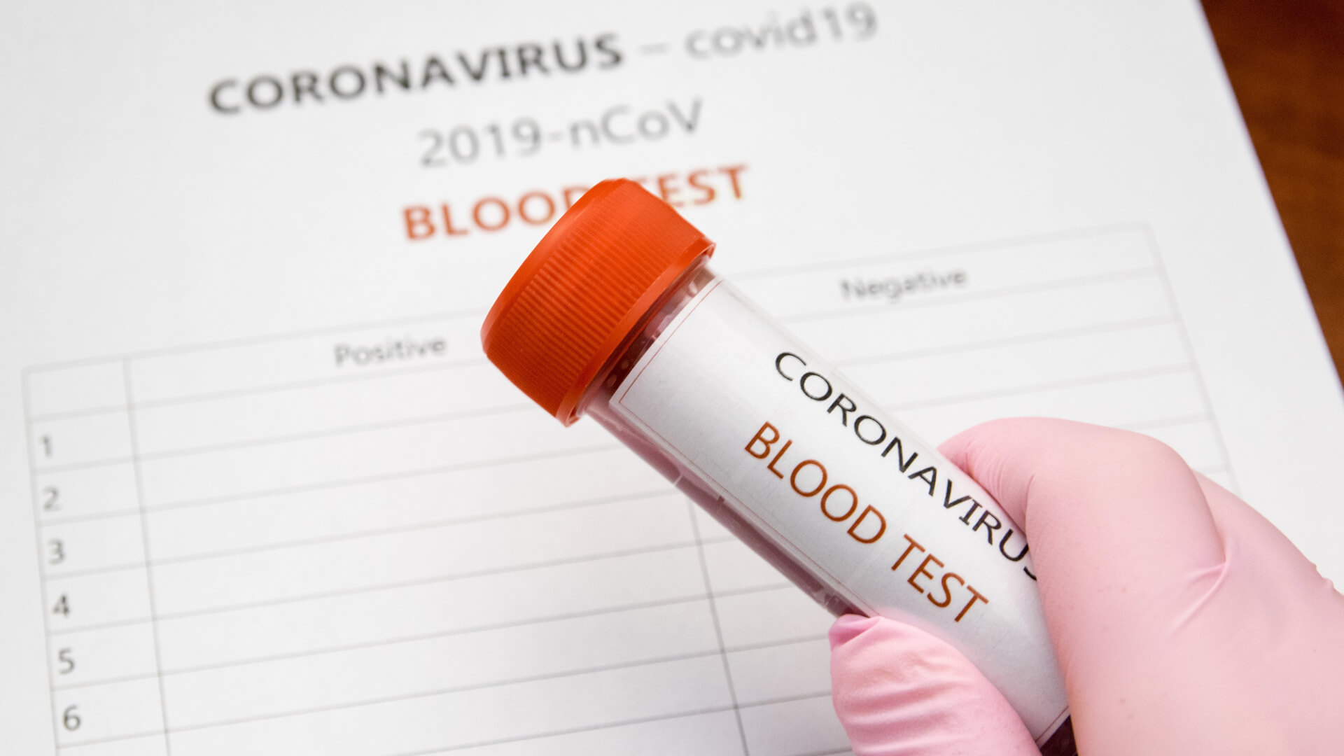 144 nowe przypadki zakażenia koronawirusem w Polsce - nie ma nowych w Podlaskiem