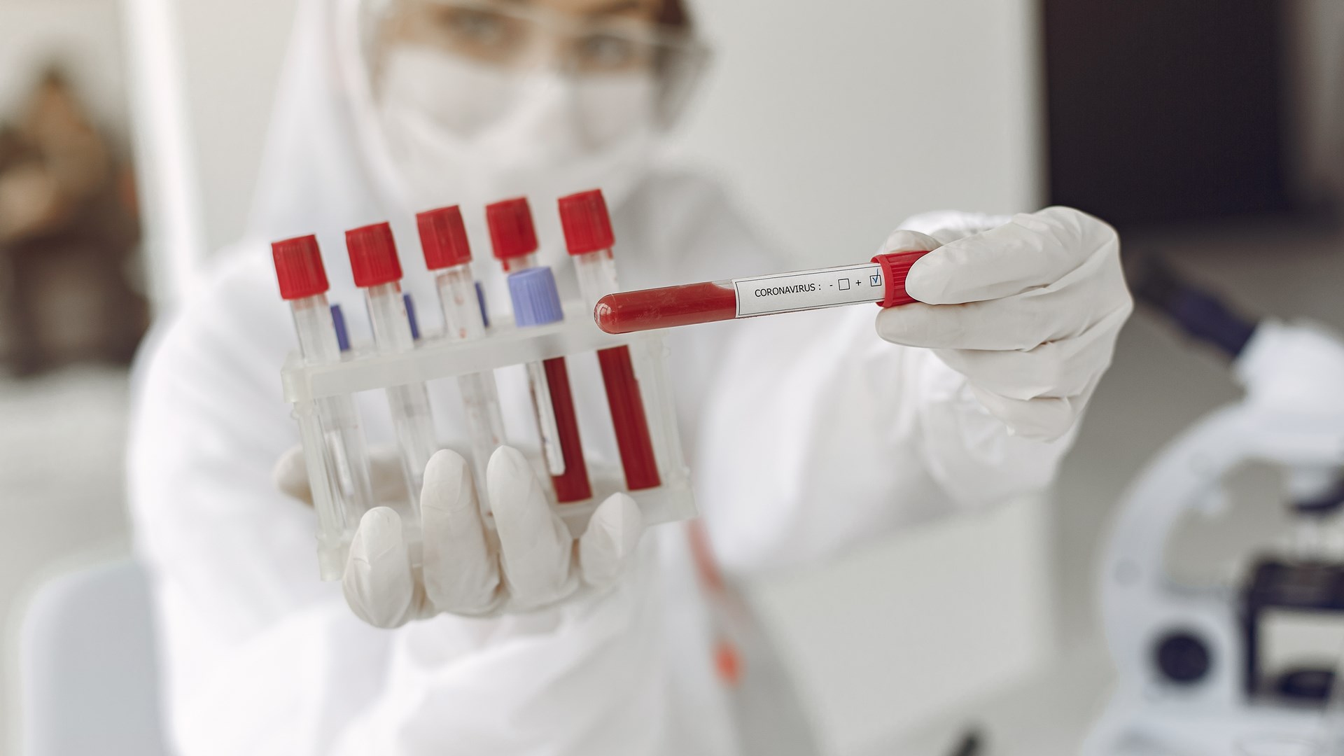 Eksperci: Wzrost zachorowań na COVID-19; szczyt przypadnie jesienią