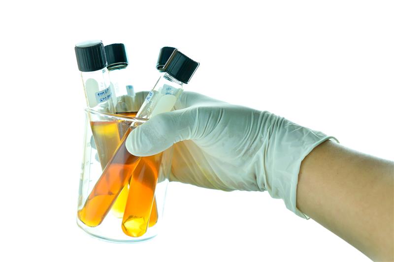 Naukowcy z UMB szukają nowych metod diagnostyki chorób odkleszczowych