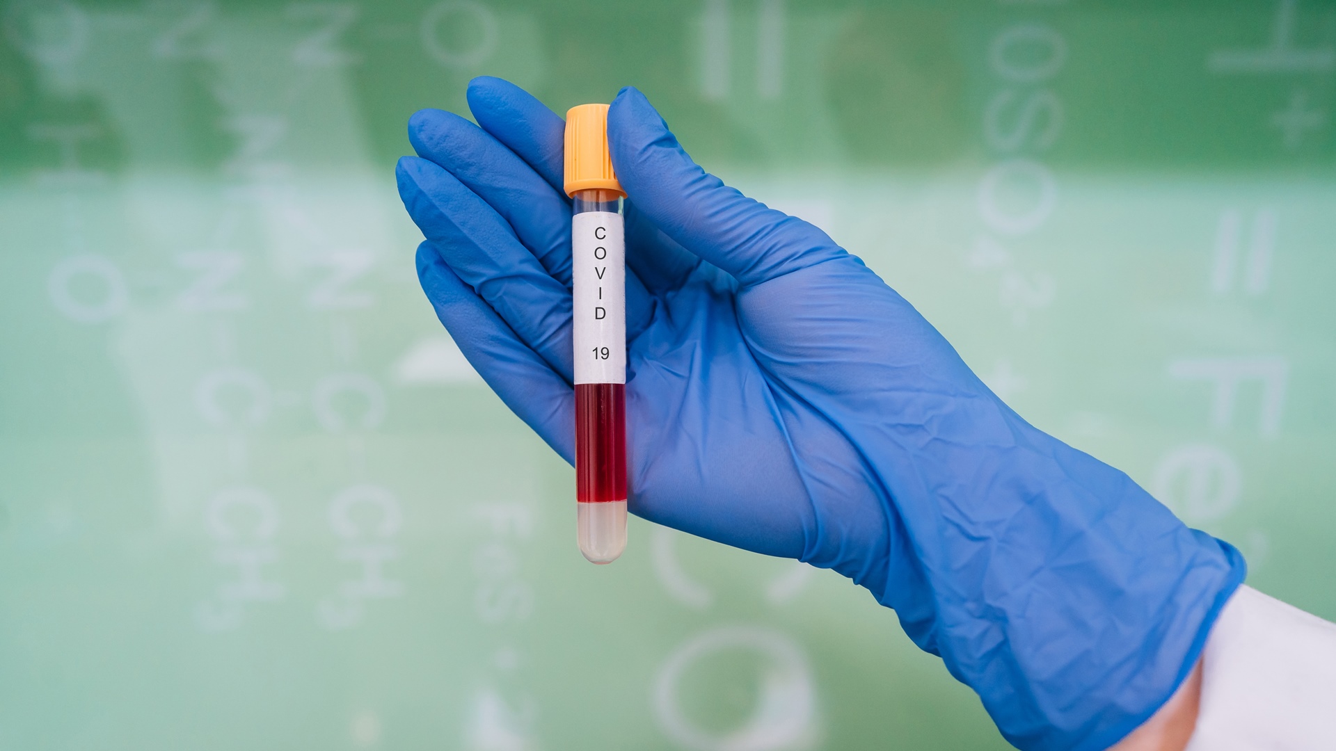 Do Polski dotarły szybkie testy na koronawirusa