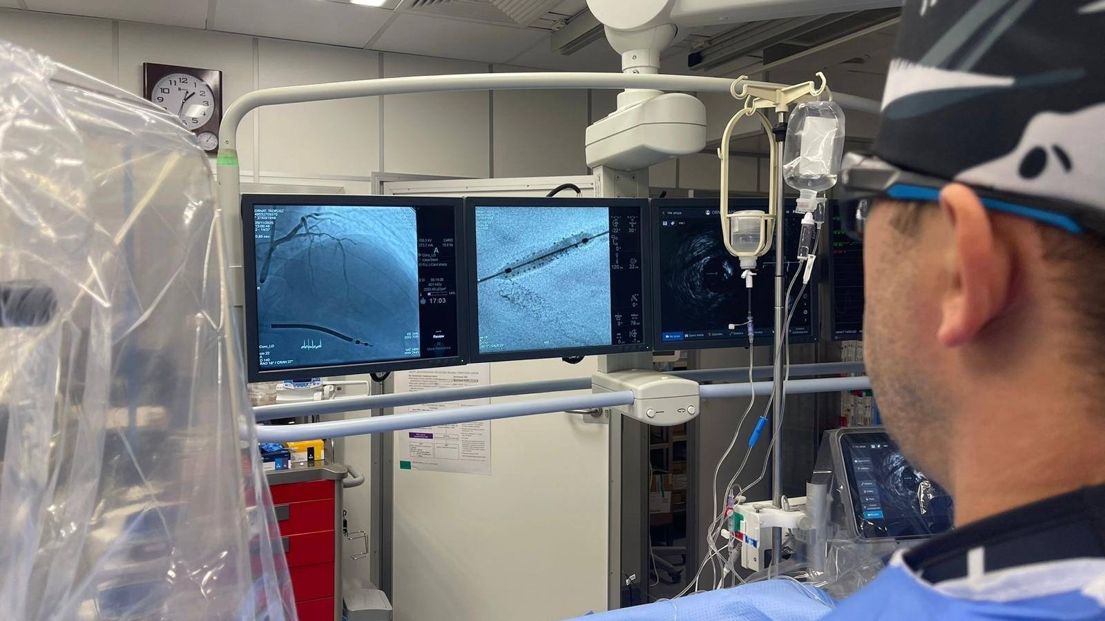 Łomżyńscy lekarze po raz pierwszy wykorzystali nowatorską technologię podczas operacji kardiologicznej